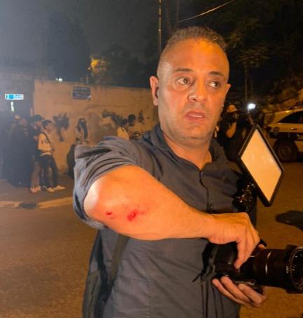 *الاعتداءات على الصحافيين مستمرة، إعلام يطالب الشرطة وقف الانتهاكات!!*